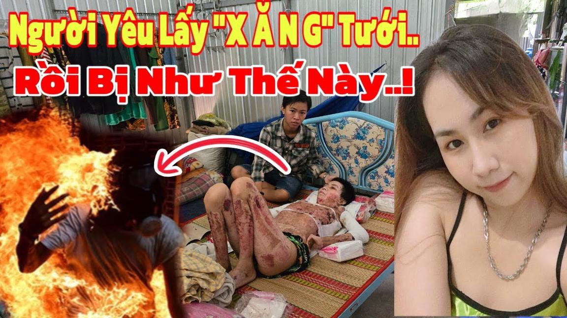 Cô Gái Xinh Đẹp Như Hoa Hậu Bị Người TÌNH Dùng X Ă N G  Đ/ốt Lúc Nữa Đêm..!